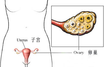 如果女性患有卵巢囊肿，应该怎么做？