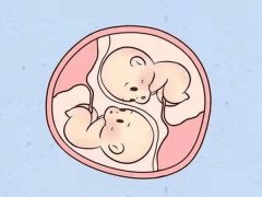 <strong>保定助孕收费-日本三胞胎试管婴儿费用不</strong>
