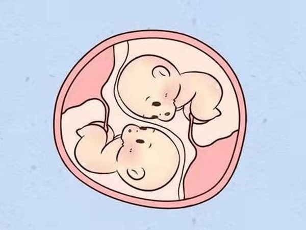 保定助孕收费-日本三胞胎试管婴儿费用不高，只需6万人民币左右